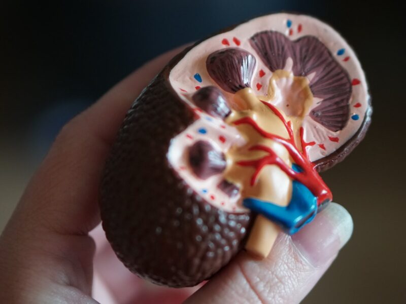 kidney scale model in hand